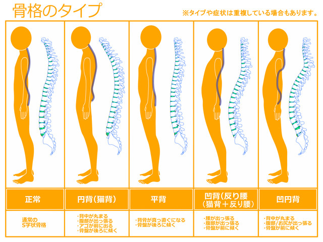 骨格のタイプ