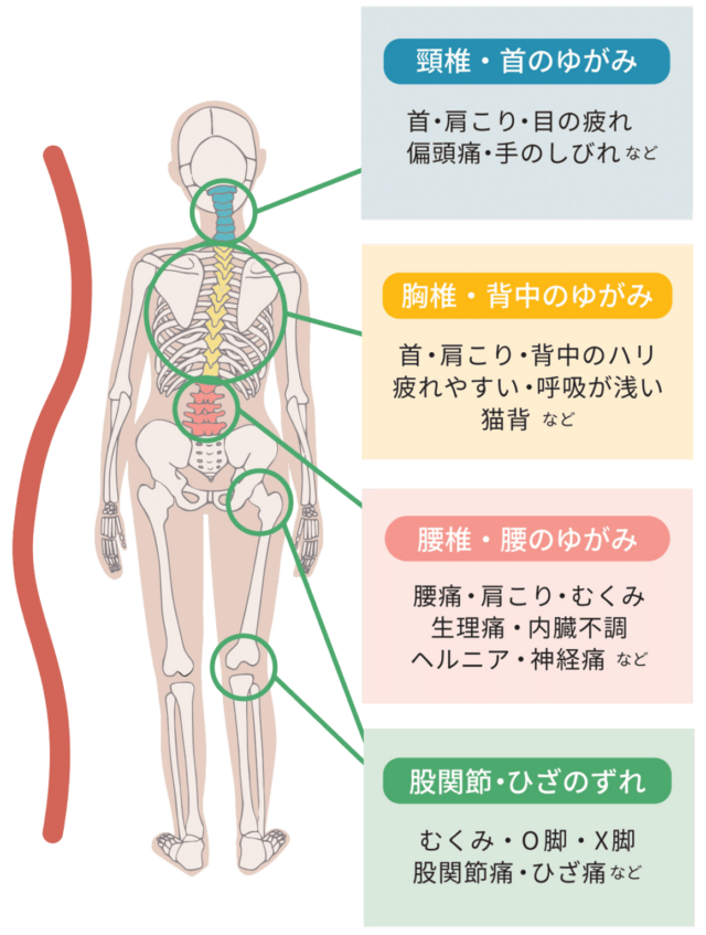 歪み