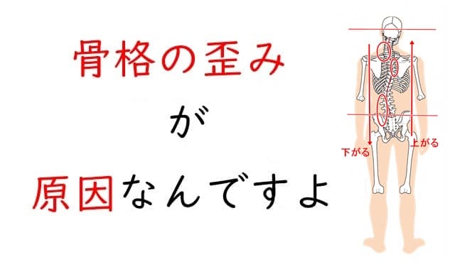 骨格の歪みが原因なんですよ