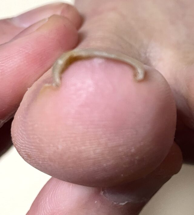 before画像